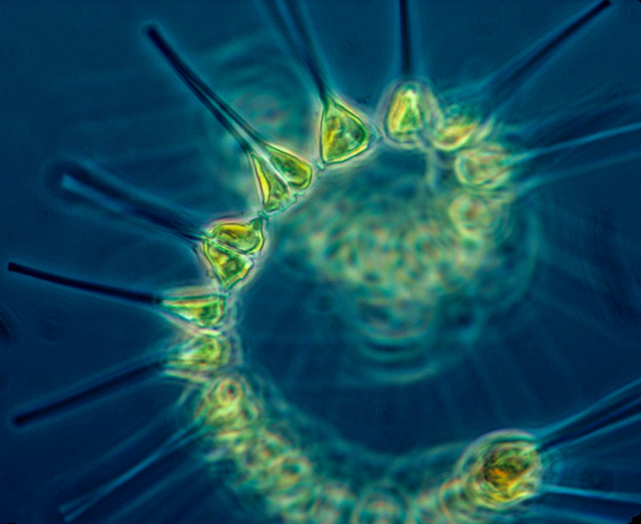 An example of phytoplankton. Photo US National Oceanic and Atmospheric Administration MESA Project.